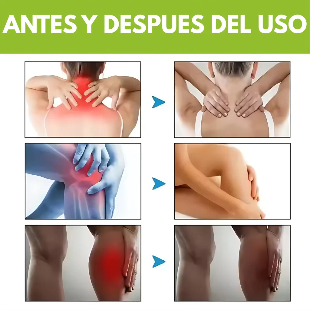 CREMA BEEVANA™ 3X1 🎁 Profesional Avanzada de Huesos y Articulaciones.