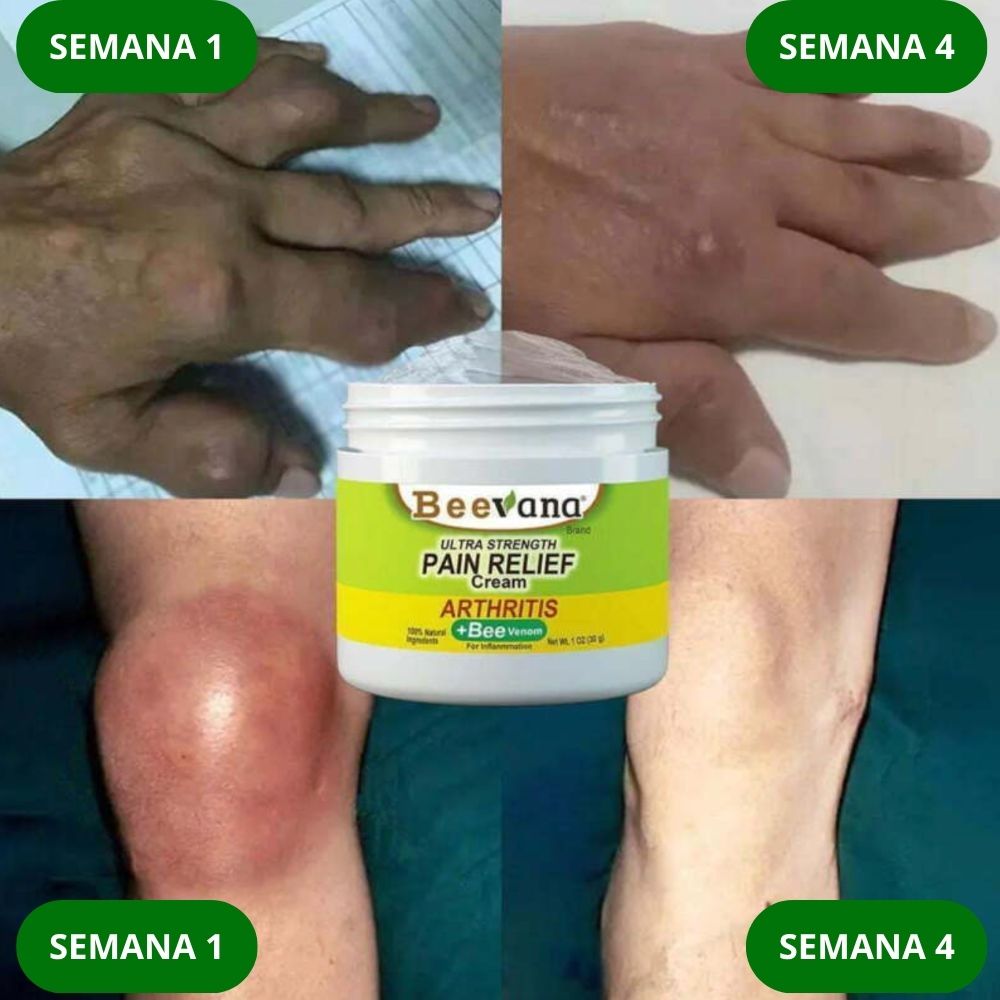 CREMA BEEVANA™ 3X1 🎁 Profesional Avanzada de Huesos y Articulaciones.